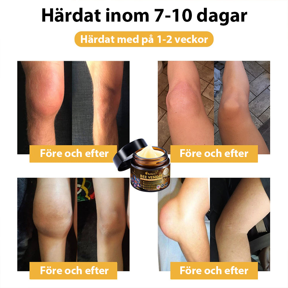 Officiell butik: Aetheris™ kräm för artritbehandling med bigift (👩🏼‍⚕️Speciellt för äldre vuxna) 🔥Sista dagskampanj 80% rabatt🔥