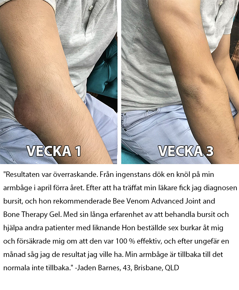 Officiell butik: Aetheris™ kräm för artritbehandling med bigift (👩🏼‍⚕️Speciellt för äldre vuxna) 🔥Sista dagskampanj 80% rabatt🔥