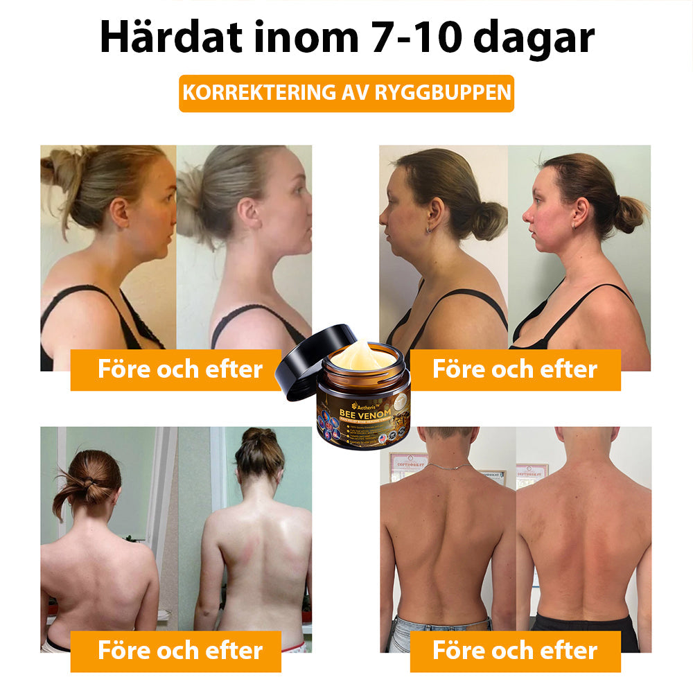 Officiell butik: Aetheris™ kräm för artritbehandling med bigift (👩🏼‍⚕️Speciellt för äldre vuxna) 🔥Sista dagskampanj 80% rabatt🔥